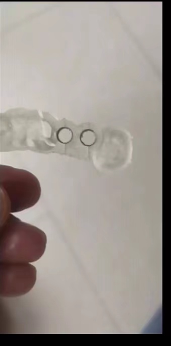 Żywica dentystyczna drukarka 3 – 3D Printing Guide recenzja i cena